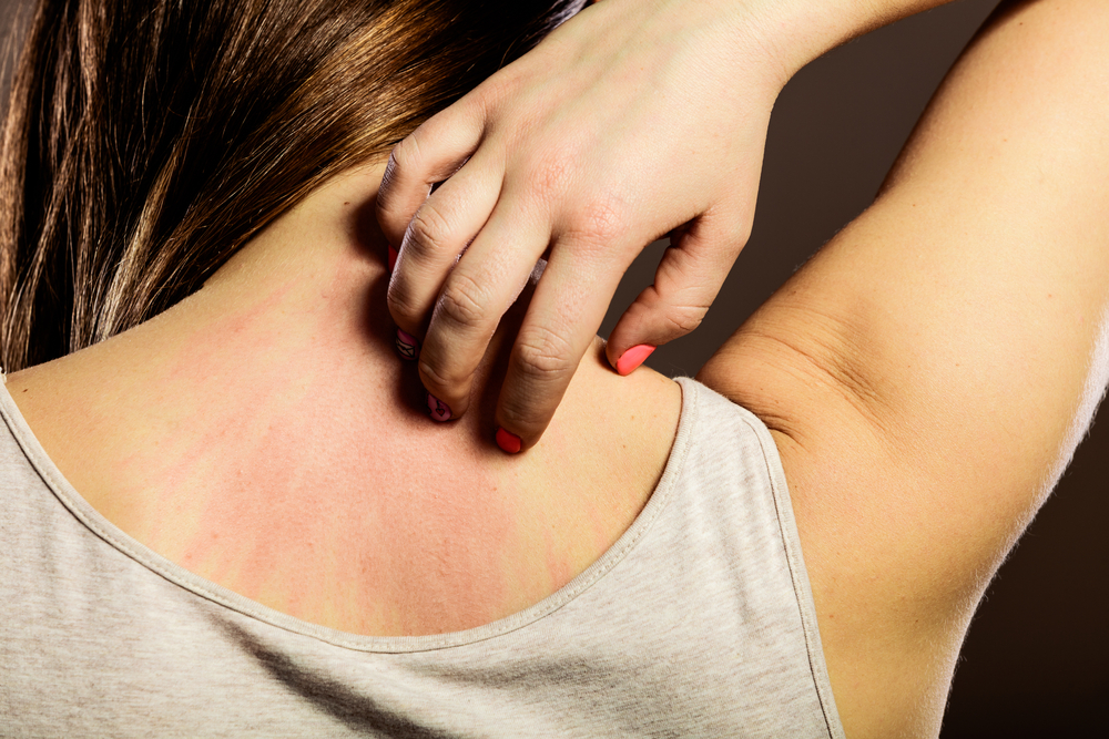 Unraveling the Mysteries of Skin Allergies - A Comprehensive Guide to 